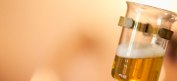 Determination of Calcium in Beer