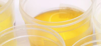 Fluoride in Urine